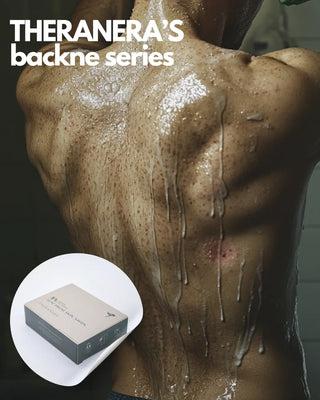 Acne-Soap-for-Body-5-Sulfur-Soap-Bar-for-Clear-Smooth-Skin Theranera