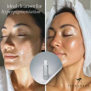 Is-Kojic-Acid-Good-For-Daily-Use Theranera